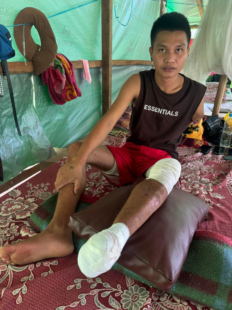 Aung Nge sitting on a floor cushion in a shelter. He has large bandages around his left foot and knee. 