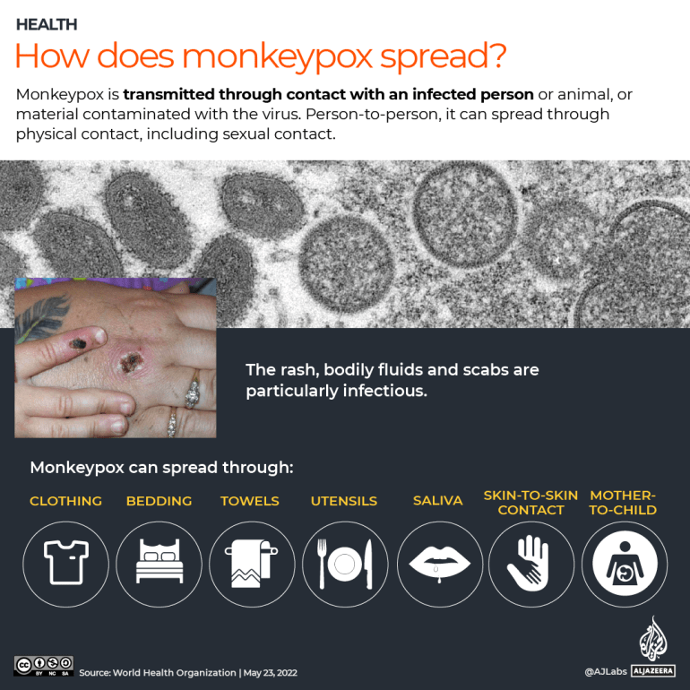 Monkeypox