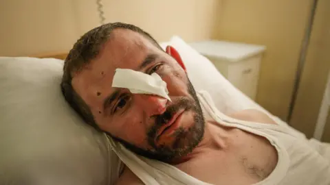 Matthew Goddard/BBC Azat Karimov, 35, was beaten up in Marneuli