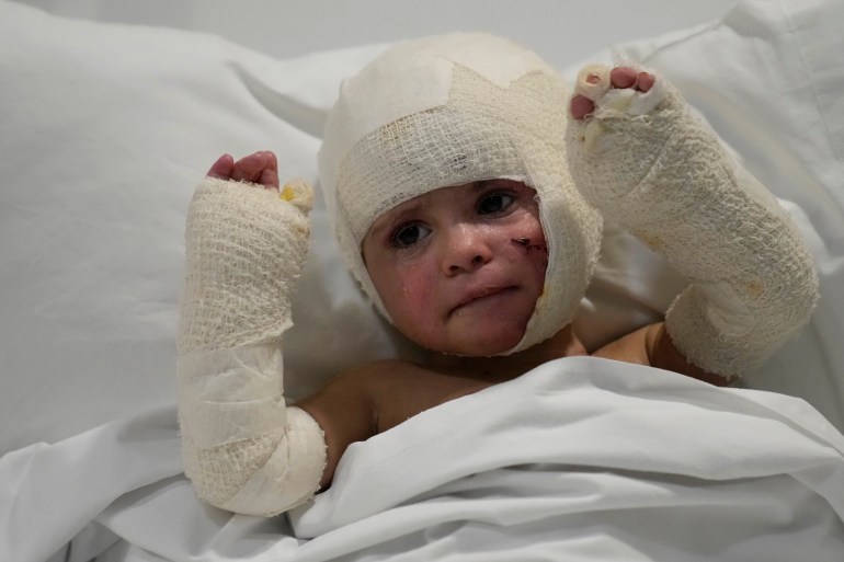 Ivana Skakye, 2, a Lebanese child who is suffering from third-degree burns over 40 percent of her body following an Israeli airstrike last September near their home in Deir Qanoun al Nahr, a village in south Lebanon, raises her burned arms as she lies on a bed at the Geitaoui hospital where she is receiving treatment, in Beirut, Lebanon, Tuesday, Oct. 29, 2024. (AP Photo/Hussein Malla)