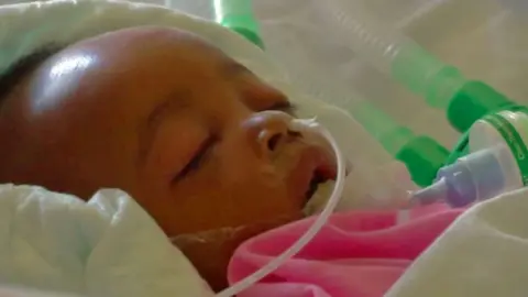 Baby Samantha Pendo pictured in hospital in 2017. She has a tub running from her nose and other tubes to her side. She is covered in a pink blanket