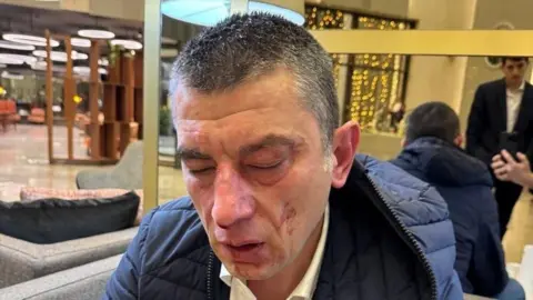 Reuters A Georgian opposition leader sits down after he is attacked at a hotel, clearly showing his injuries